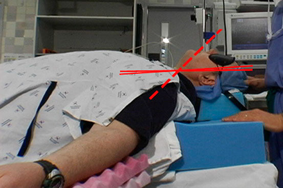 Tricky Intubations: Airway Axes and Patient Positioning