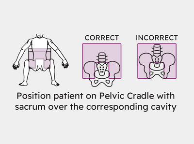 Pelvic Cradle | Single-Use Barrier Covers | Box of 20